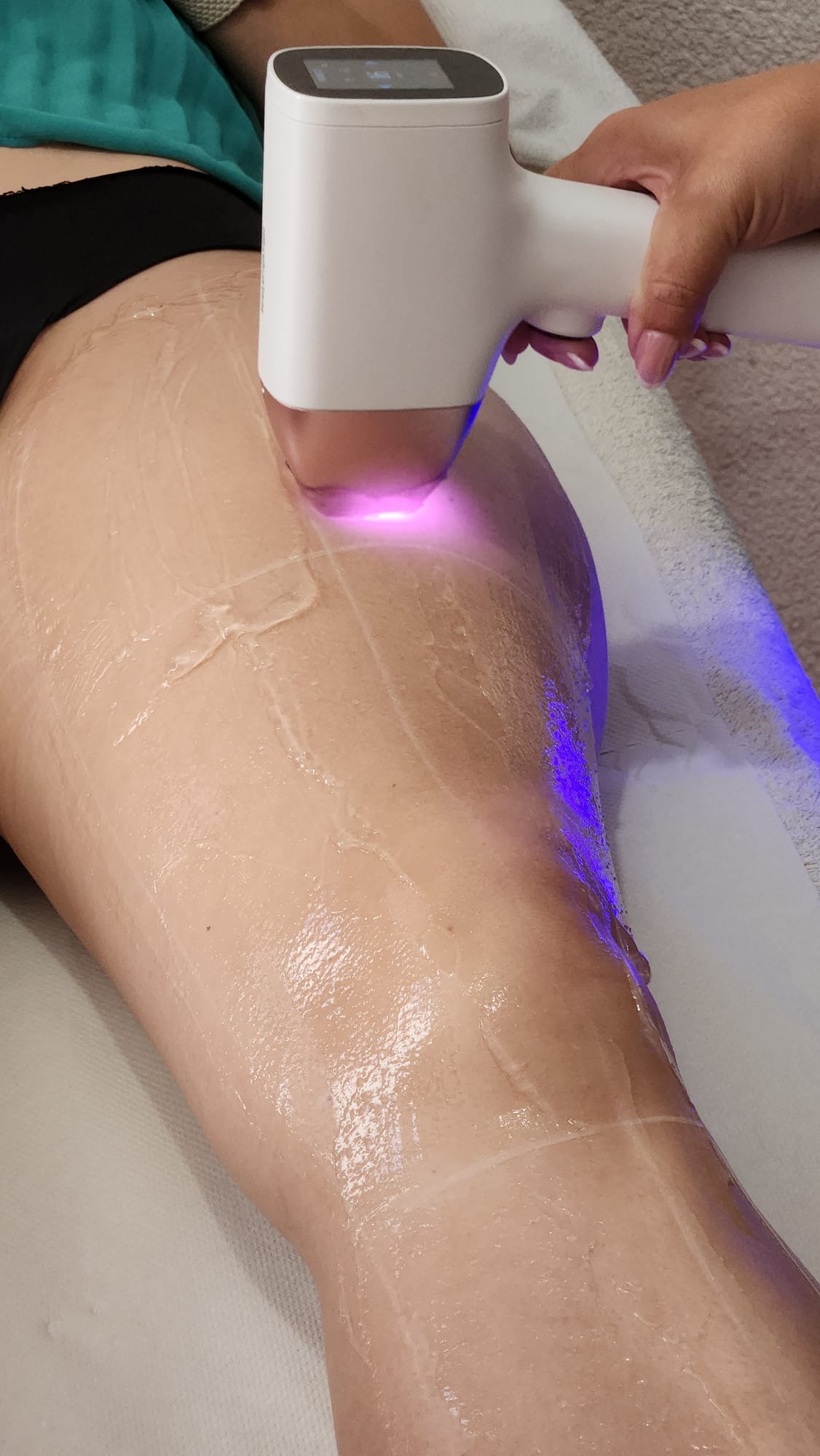 épilation définitive - Nymphéa institut alès